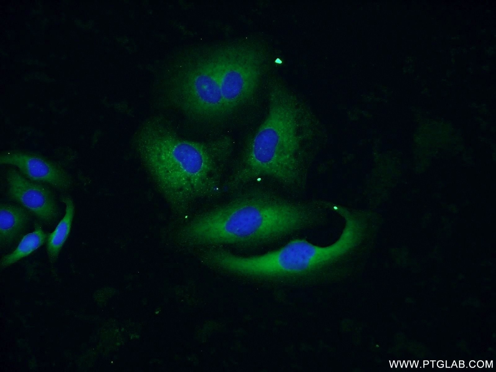 Immunofluorescence (IF) / fluorescent staining of SKOV-3 cells using AGR3 Polyclonal antibody (11967-1-AP)