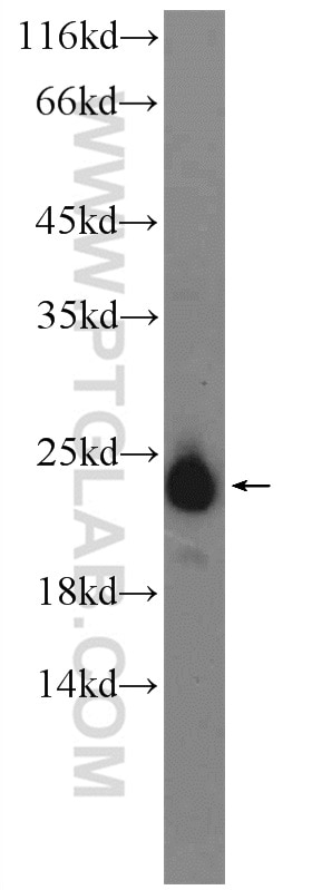 Western Blot (WB) analysis of SKOV-3 cells using AGR3 Polyclonal antibody (11967-1-AP)
