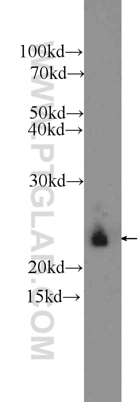 Western Blot (WB) analysis of SKOV-3 cells using AGR3 Polyclonal antibody (11967-1-AP)