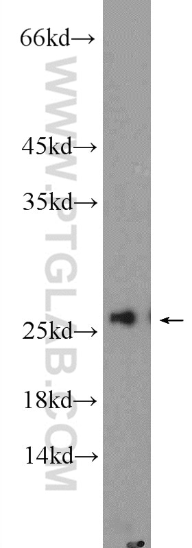 Western Blot (WB) analysis of MCF-7 cells using AGR3 Polyclonal antibody (11967-1-AP)