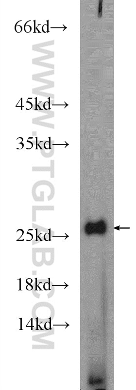 Western Blot (WB) analysis of MCF-7 cells using AGR3 Polyclonal antibody (11967-1-AP)