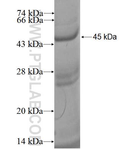 AGR3 fusion protein Ag2577 SDS-PAGE