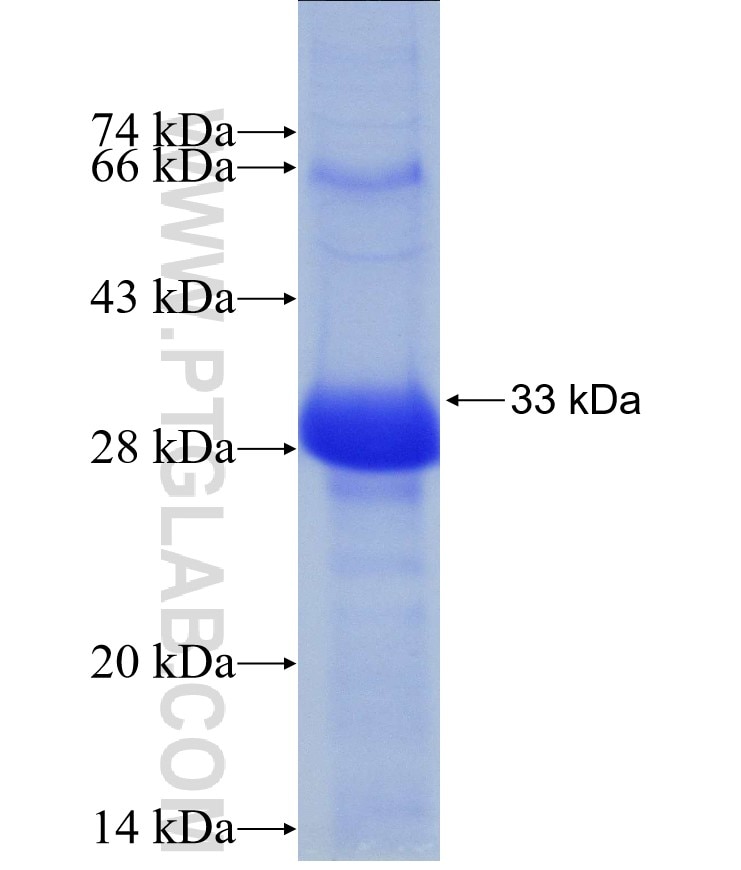AGRE1 fusion protein Ag30149 SDS-PAGE