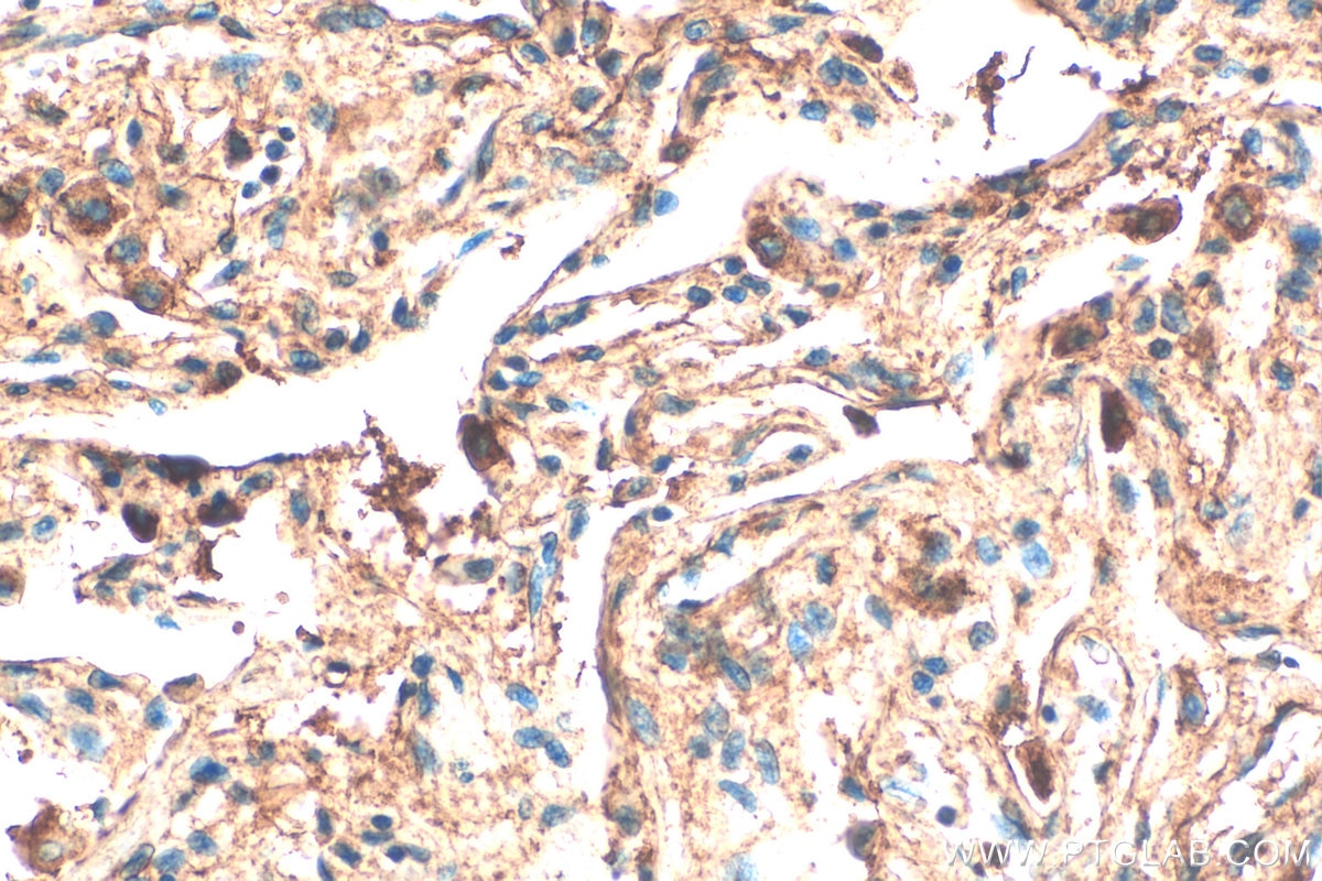 Immunohistochemistry (IHC) staining of human lung tissue using AGRN Polyclonal antibody (20692-1-AP)