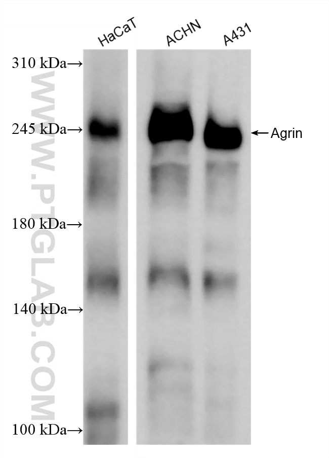 Western Blot (WB) analysis of various lysates using AGRN Recombinant antibody (86507-3-RR)