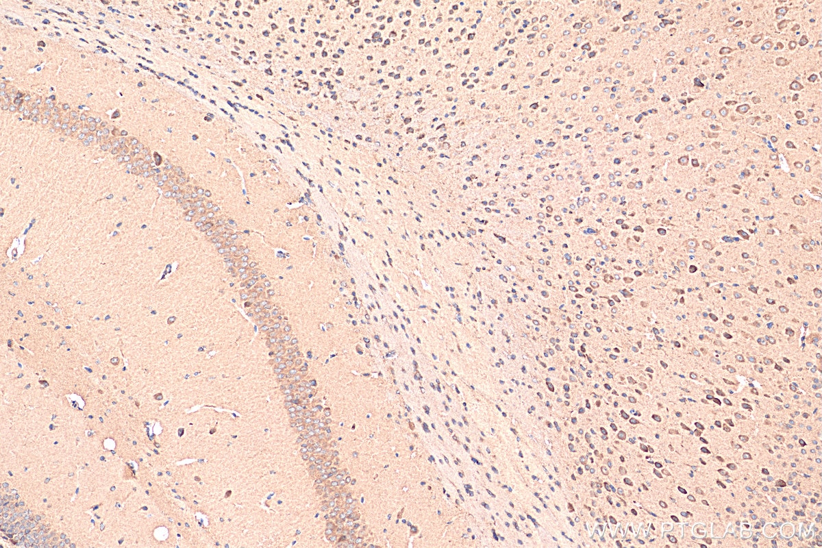 Immunohistochemistry (IHC) staining of mouse brain tissue using AGRP Polyclonal antibody (21249-1-AP)