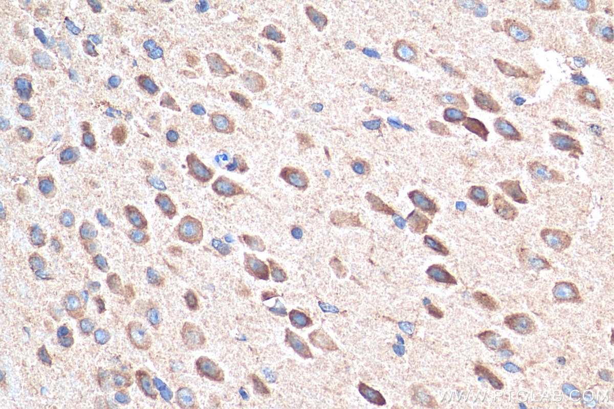 Immunohistochemistry (IHC) staining of mouse brain tissue using AGRP Polyclonal antibody (21249-1-AP)