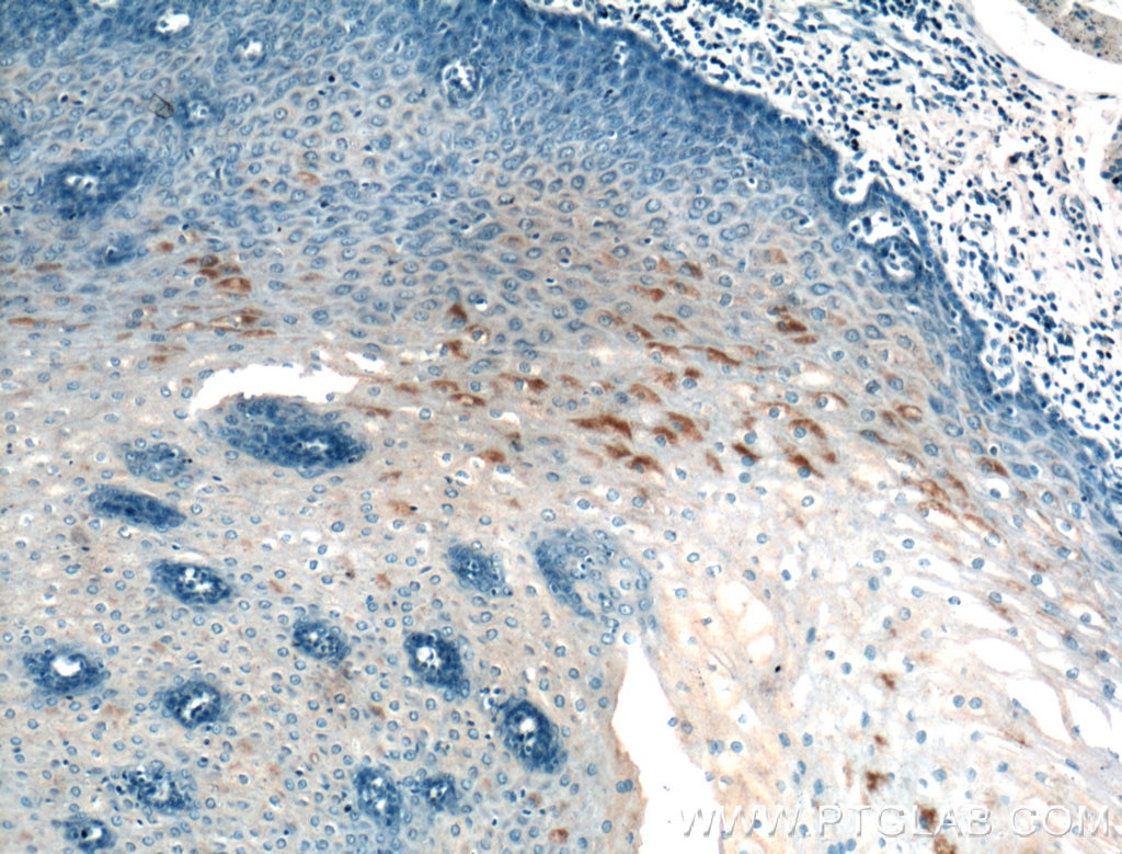 Immunohistochemistry (IHC) staining of human oesophagus tissue using AGRP Polyclonal antibody (21249-1-AP)