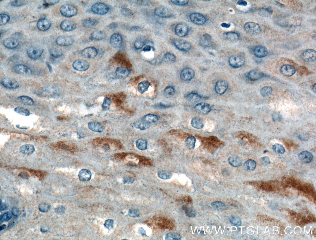 Immunohistochemistry (IHC) staining of human oesophagus tissue using AGRP Polyclonal antibody (21249-1-AP)