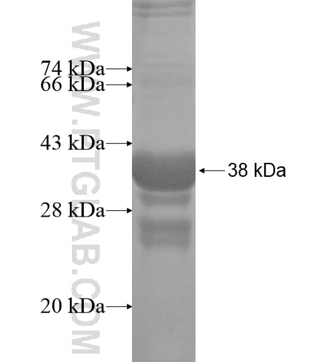 AGRP fusion protein Ag15752 SDS-PAGE