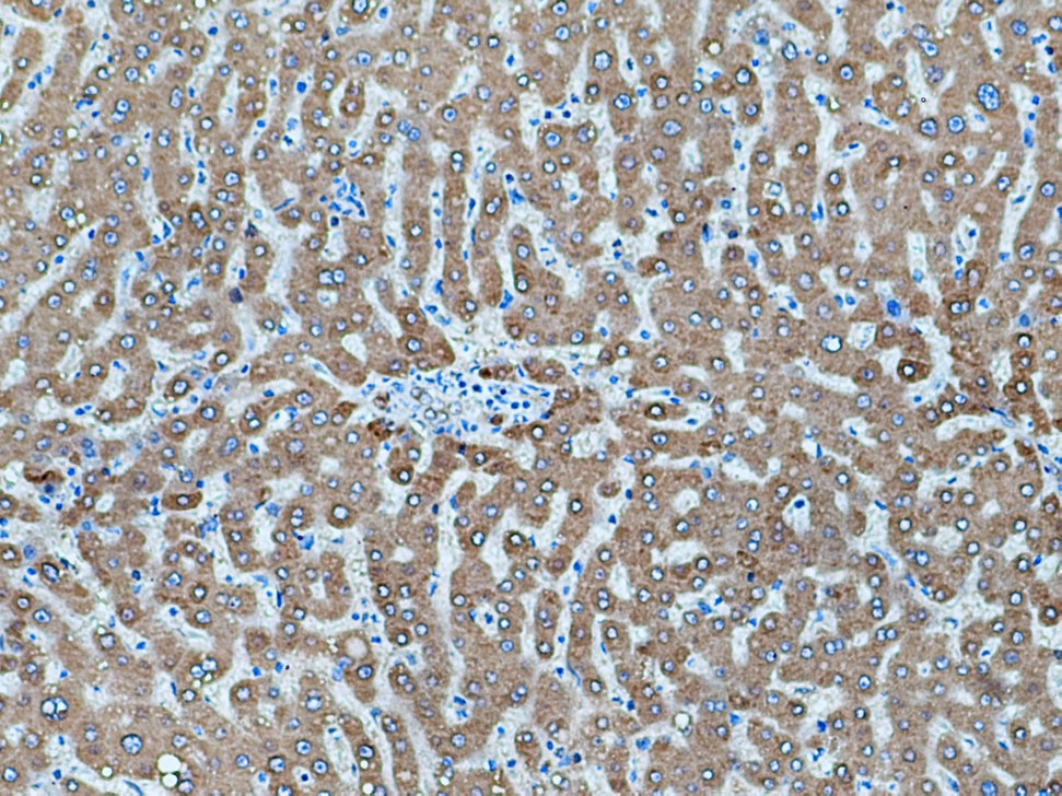 Immunohistochemistry (IHC) staining of human liver tissue using Angiotensinogen Polyclonal antibody (11992-1-AP)