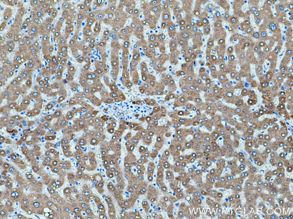 Immunohistochemistry (IHC) staining of human liver tissue using Angiotensinogen Polyclonal antibody (11992-1-AP)