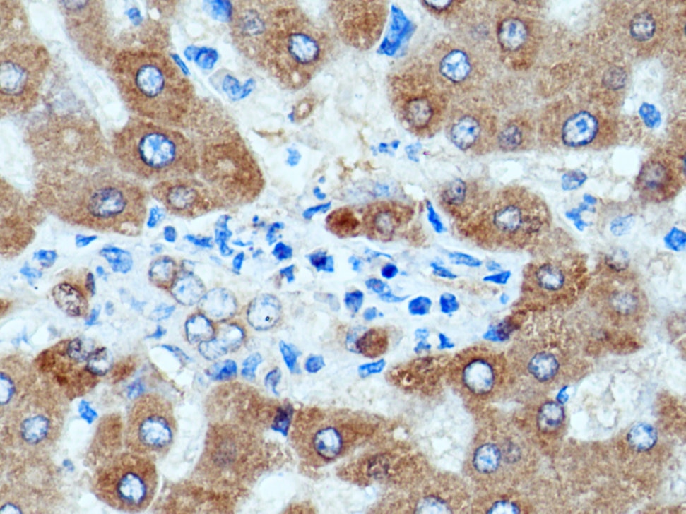 Immunohistochemistry (IHC) staining of human liver tissue using Angiotensinogen Polyclonal antibody (11992-1-AP)