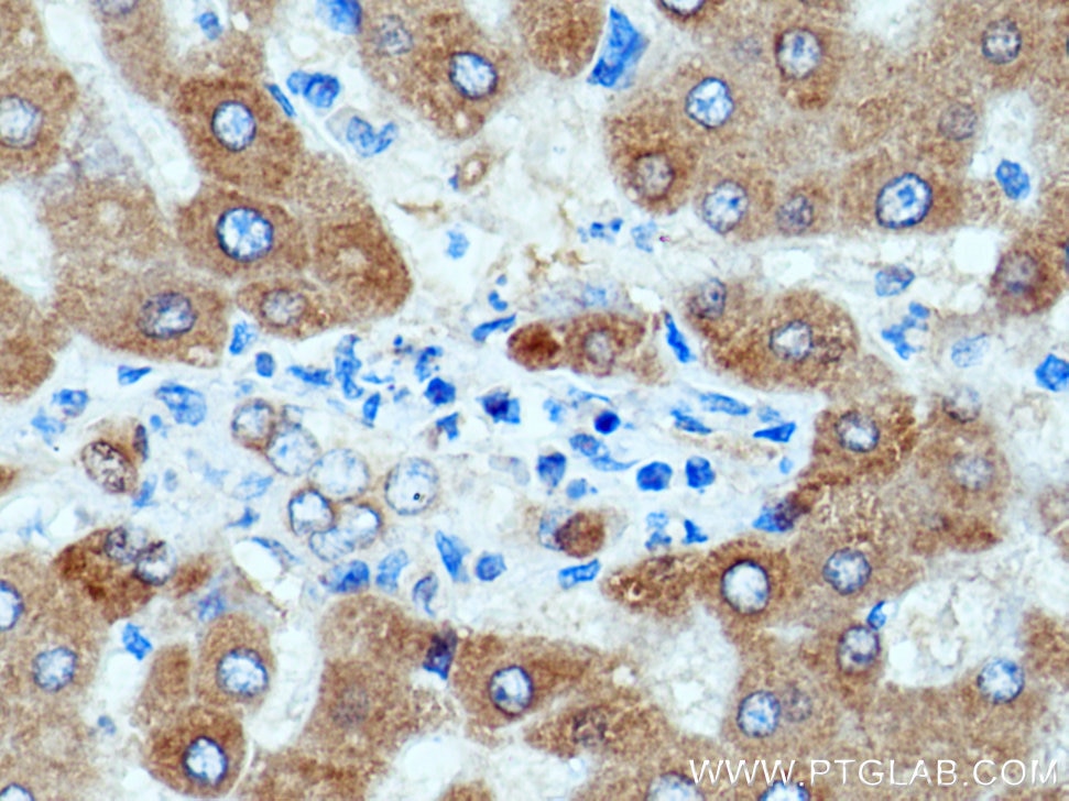 IHC staining of human liver using 11992-1-AP