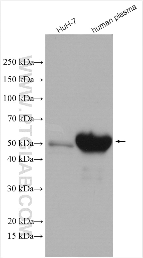 Western Blot (WB) analysis of various lysates using Angiotensinogen Polyclonal antibody (11992-1-AP)