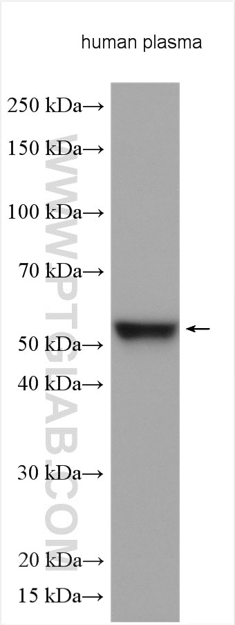 Western Blot (WB) analysis of various lysates using Angiotensinogen Polyclonal antibody (11992-1-AP)