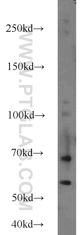Western Blot (WB) analysis of HepG2 cells using Angiotensinogen Polyclonal antibody (11992-1-AP)