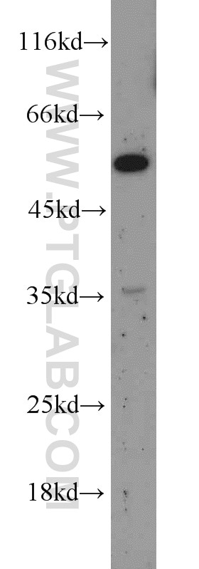 Western Blot (WB) analysis of HepG2 cells using Angiotensinogen Polyclonal antibody (11992-1-AP)