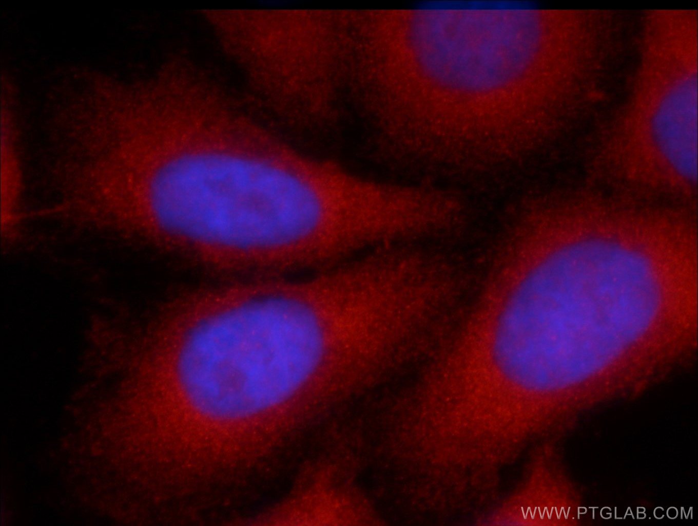 Immunofluorescence (IF) / fluorescent staining of HepG2 cells using Angiotensinogen Polyclonal antibody (23972-1-AP)