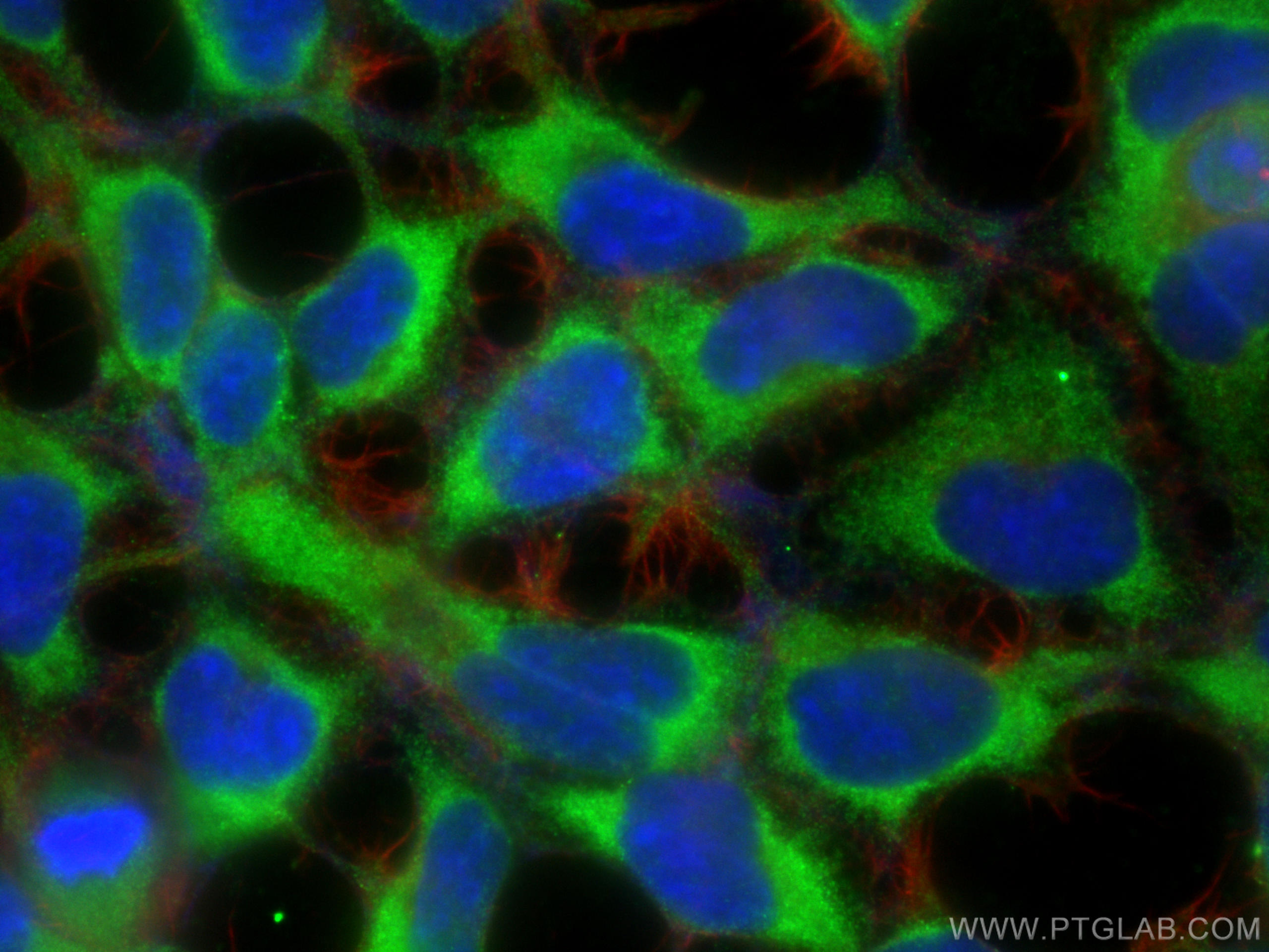 Immunofluorescence (IF) / fluorescent staining of HEK-293 cells using Angiotensinogen Polyclonal antibody (23972-1-AP)