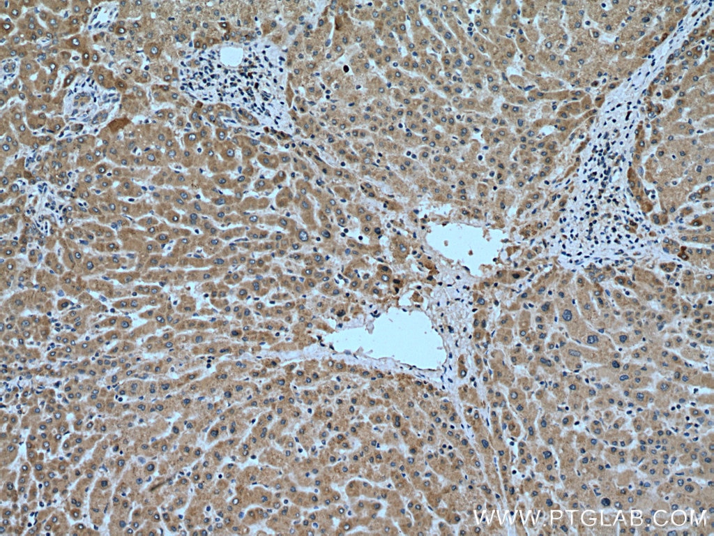 Immunohistochemistry (IHC) staining of human liver tissue using Angiotensinogen Polyclonal antibody (23972-1-AP)