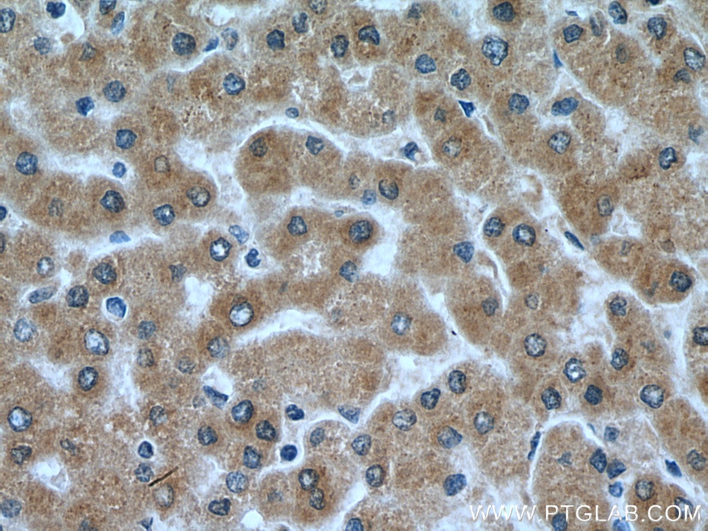 Immunohistochemistry (IHC) staining of human liver tissue using Angiotensinogen Polyclonal antibody (23972-1-AP)