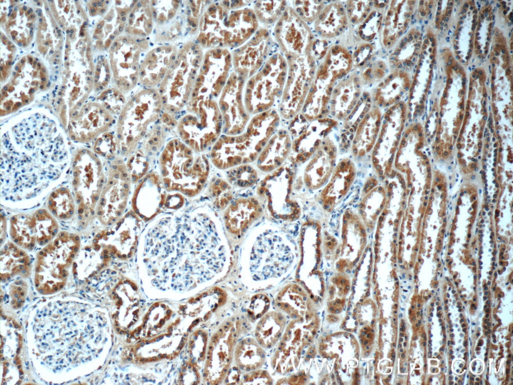 Immunohistochemistry (IHC) staining of human kidney tissue using Angiotensinogen Polyclonal antibody (23972-1-AP)