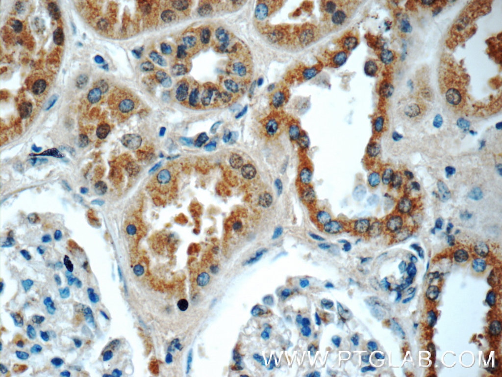 Immunohistochemistry (IHC) staining of human kidney tissue using Angiotensinogen Polyclonal antibody (23972-1-AP)