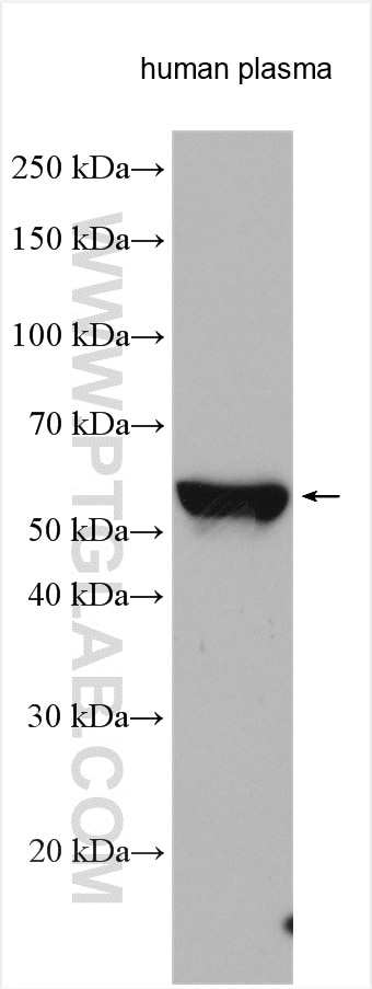 Western Blot (WB) analysis of various lysates using Angiotensinogen Polyclonal antibody (23972-1-AP)