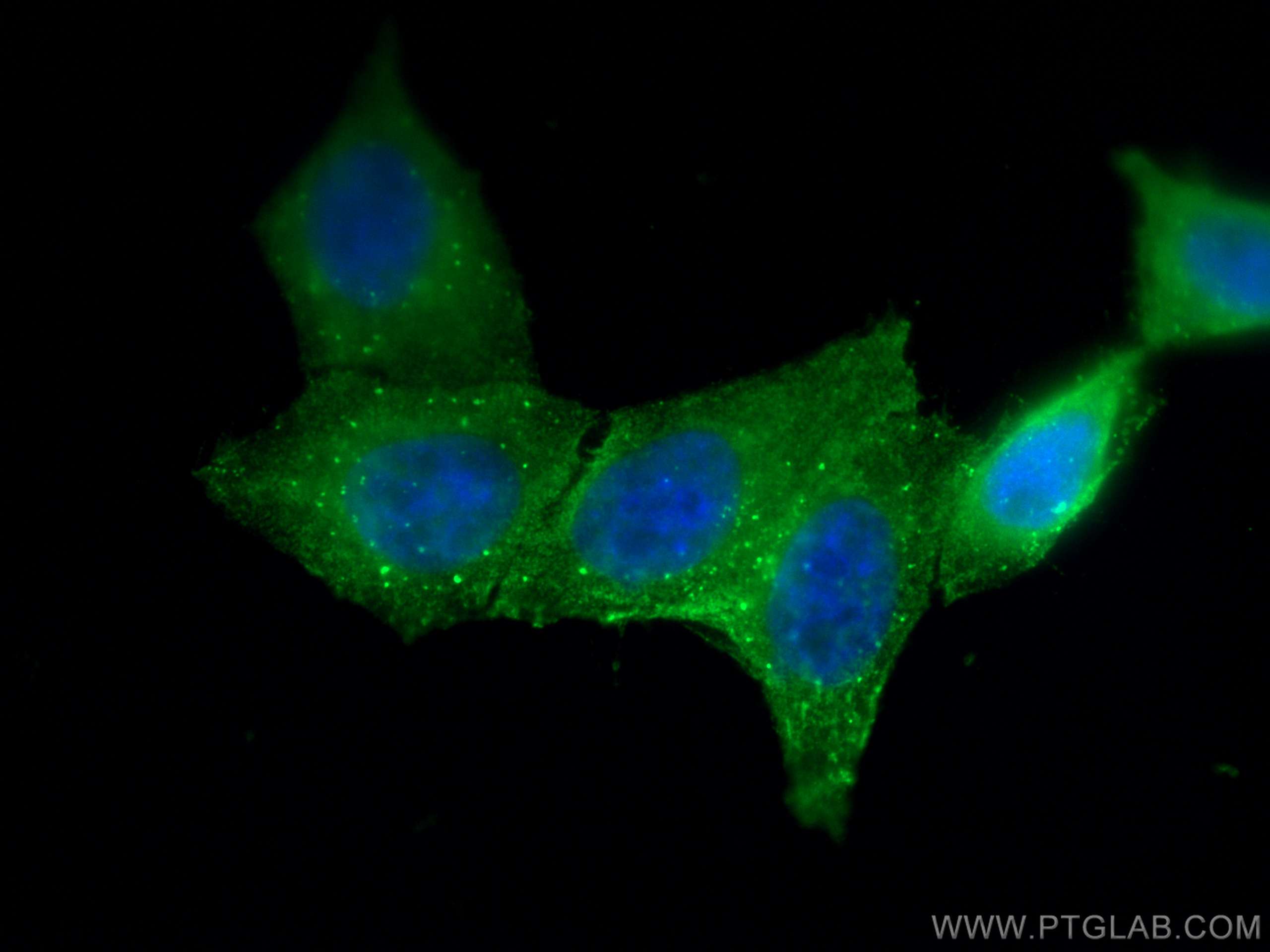 Immunofluorescence (IF) / fluorescent staining of HepG2 cells using AGT Monoclonal antibody (68020-1-Ig)