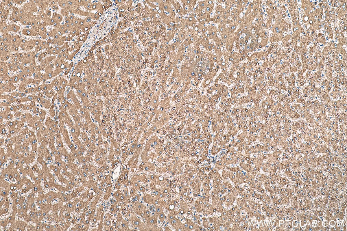 Immunohistochemistry (IHC) staining of human liver tissue using AGT Monoclonal antibody (68020-1-Ig)