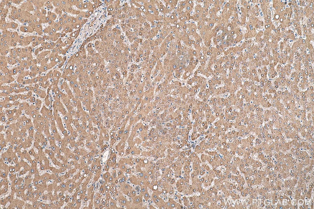 IHC staining of human liver using 68020-1-Ig