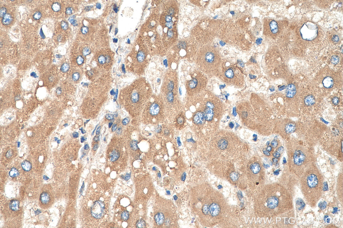 Immunohistochemistry (IHC) staining of human liver tissue using AGT Monoclonal antibody (68020-1-Ig)