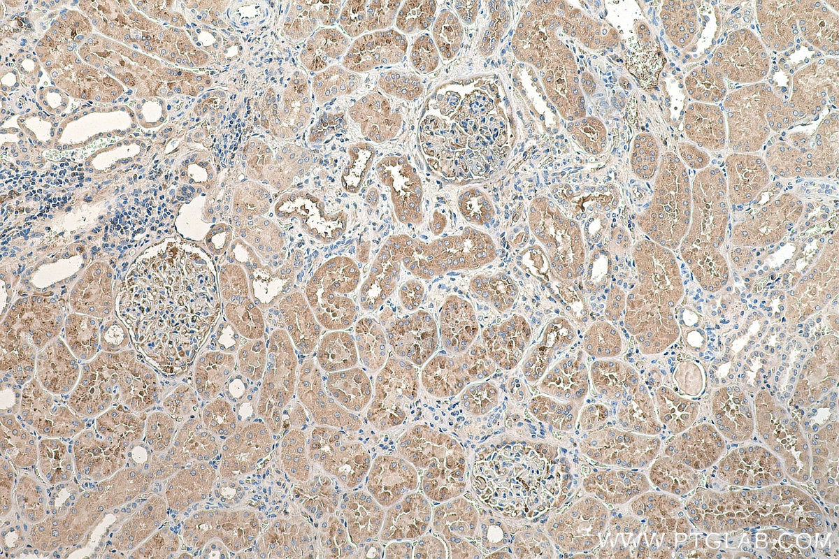 Immunohistochemistry (IHC) staining of human kidney tissue using AGT Monoclonal antibody (68020-1-Ig)