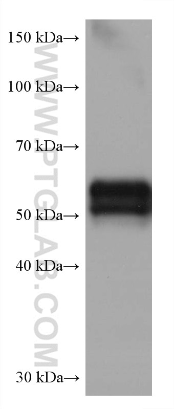 Western Blot (WB) analysis of human placenta tissue using AGT Monoclonal antibody (68020-1-Ig)