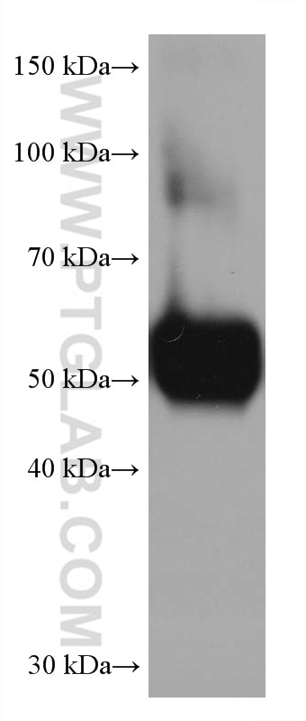 Western Blot (WB) analysis of human plasma using AGT Monoclonal antibody (68020-1-Ig)