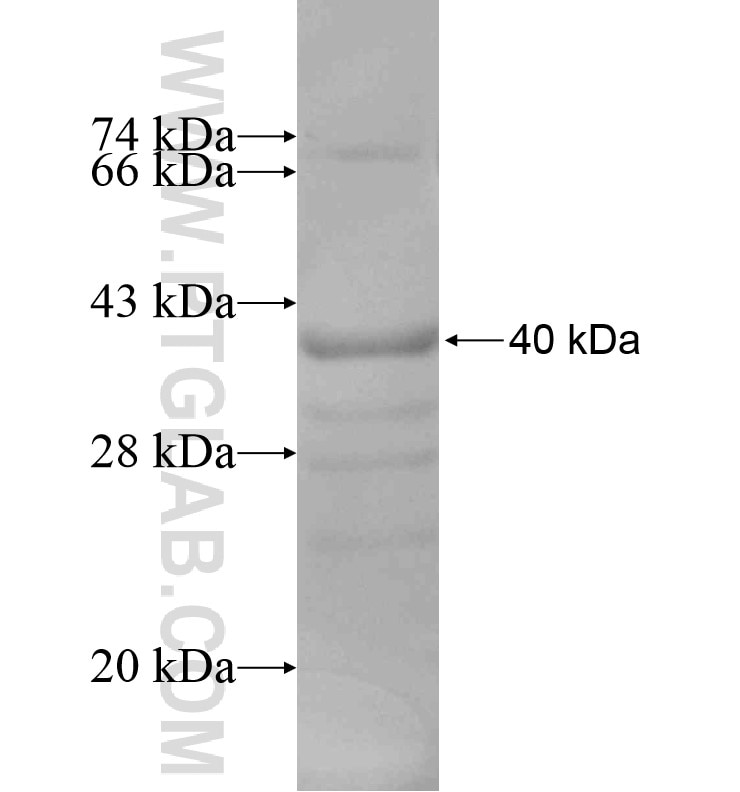AGT fusion protein Ag16658 SDS-PAGE