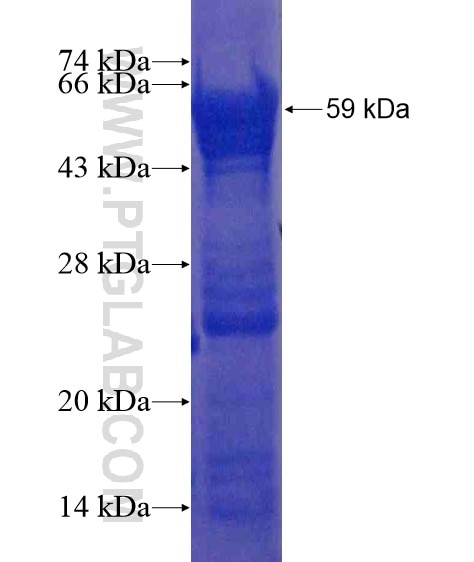 AGT fusion protein Ag21121 SDS-PAGE