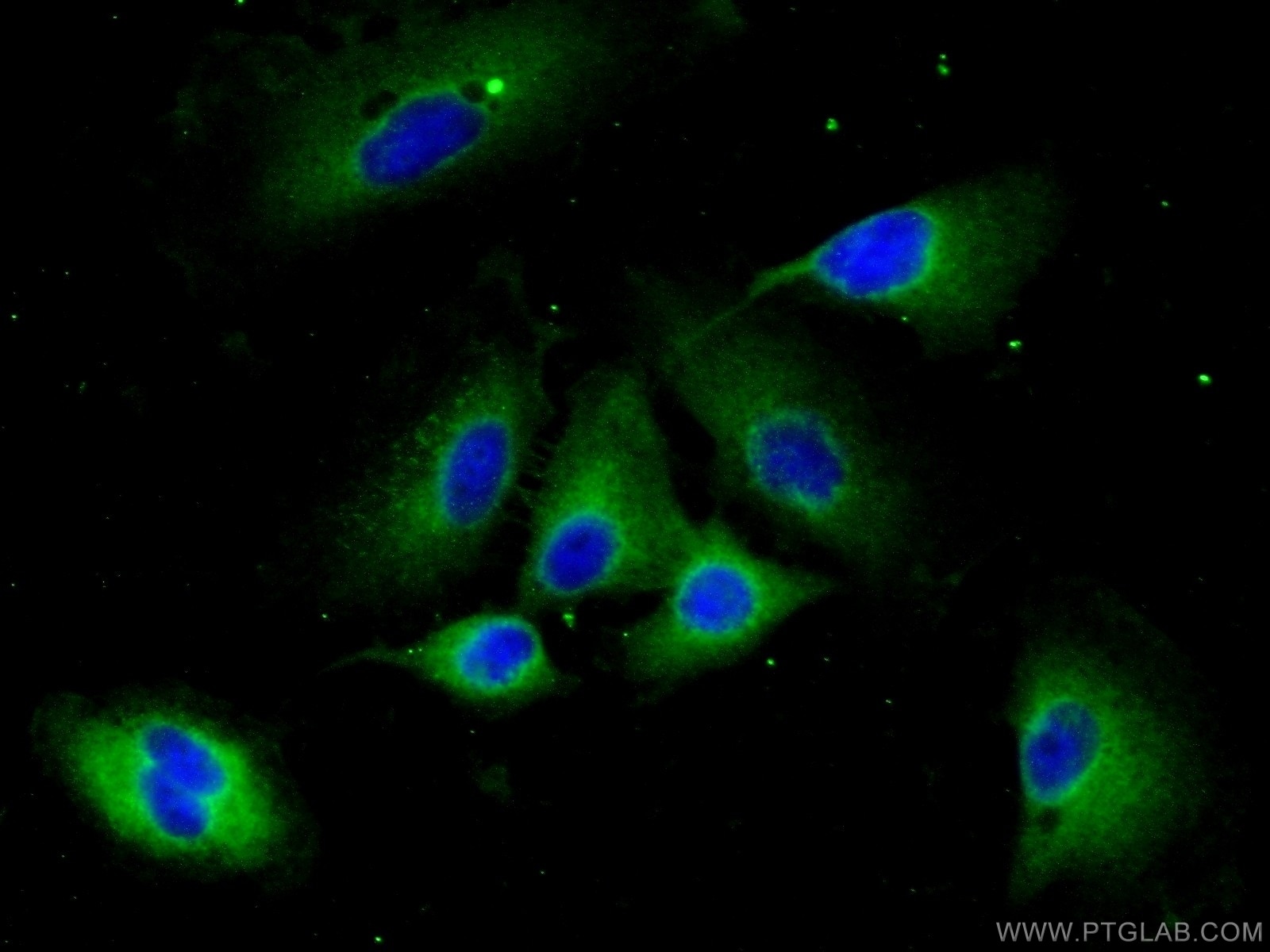 Immunofluorescence (IF) / fluorescent staining of A549 cells using CCP1 Polyclonal antibody (14067-1-AP)