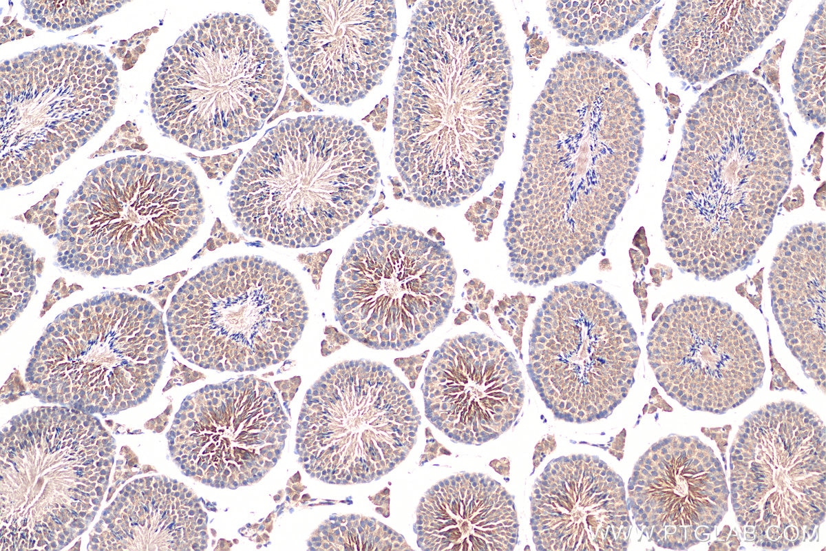 Immunohistochemistry (IHC) staining of mouse testis tissue using CCP1 Polyclonal antibody (14067-1-AP)