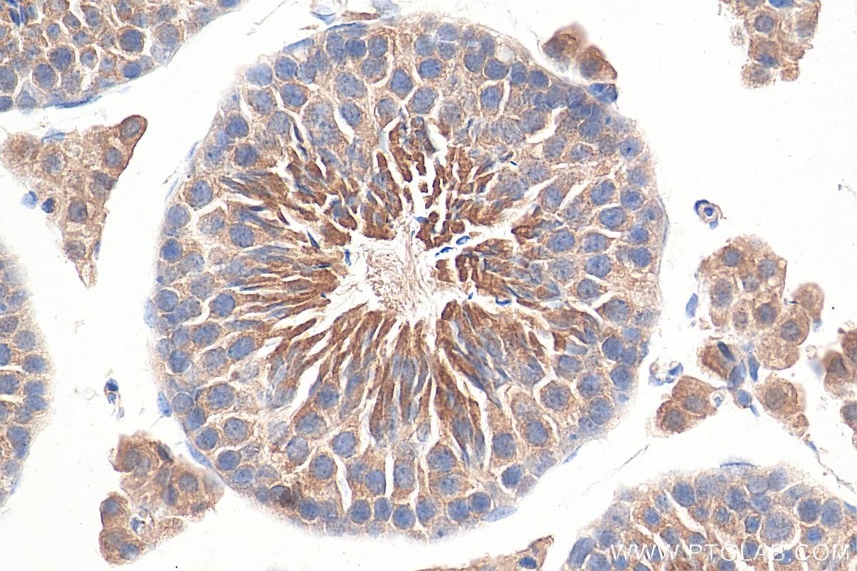 Immunohistochemistry (IHC) staining of mouse testis tissue using CCP1 Polyclonal antibody (14067-1-AP)