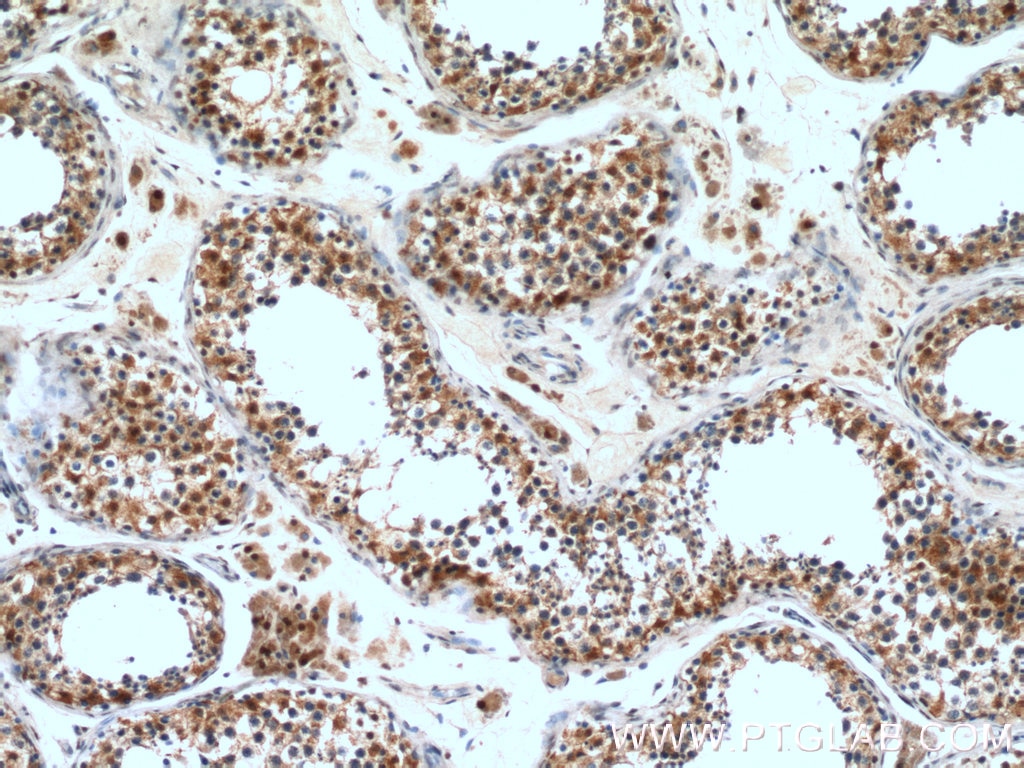 Immunohistochemistry (IHC) staining of human testis tissue using CCP1 Polyclonal antibody (14067-1-AP)