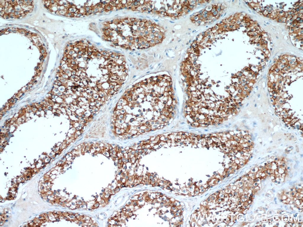 Immunohistochemistry (IHC) staining of human testis tissue using CCP1 Polyclonal antibody (14067-1-AP)