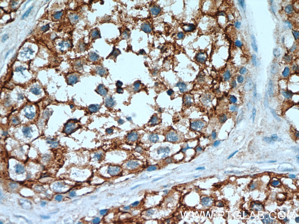 Immunohistochemistry (IHC) staining of human testis tissue using CCP1 Polyclonal antibody (14067-1-AP)