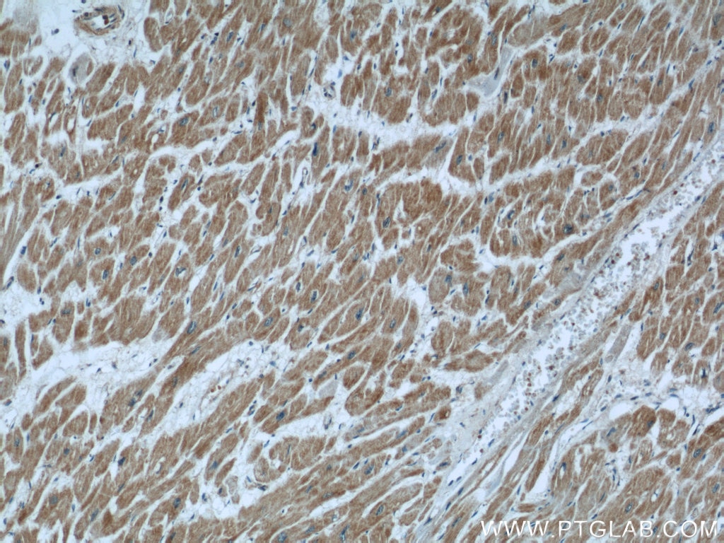 Immunohistochemistry (IHC) staining of human heart tissue using CCP1 Polyclonal antibody (14067-1-AP)