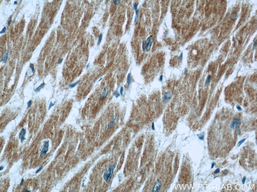 Immunohistochemistry (IHC) staining of human heart tissue using CCP1 Polyclonal antibody (14067-1-AP)