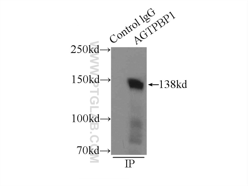 Immunoprecipitation (IP) experiment of mouse testis tissue using CCP1 Polyclonal antibody (14067-1-AP)