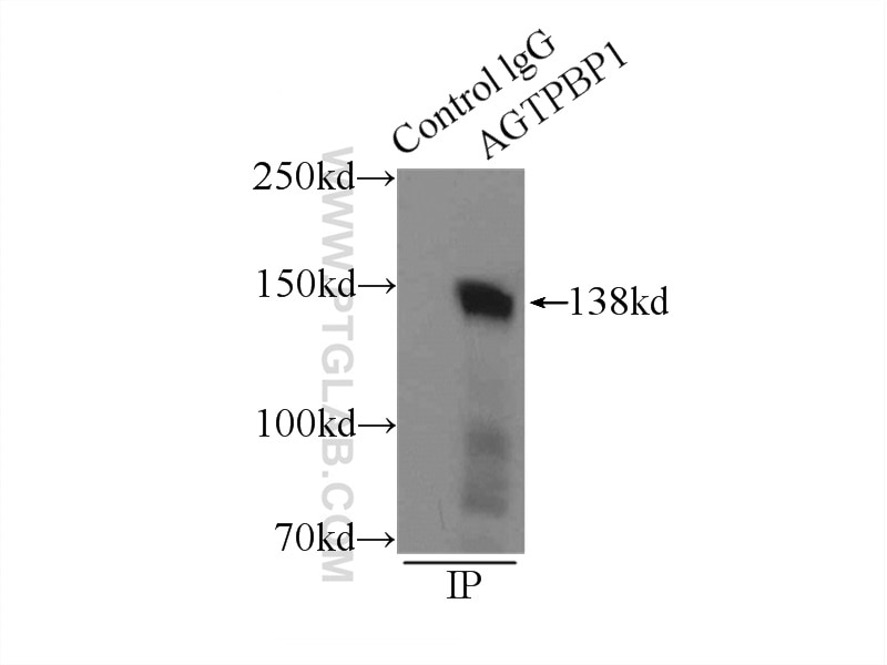 IP experiment of mouse testis using 14067-1-AP