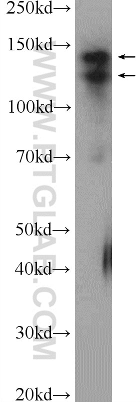 Western Blot (WB) analysis of mouse testis tissue using CCP1 Polyclonal antibody (14067-1-AP)