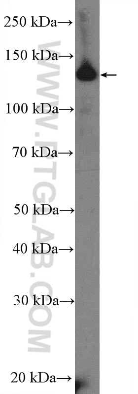 Western Blot (WB) analysis of mouse brain tissue using CCP1 Polyclonal antibody (14067-1-AP)